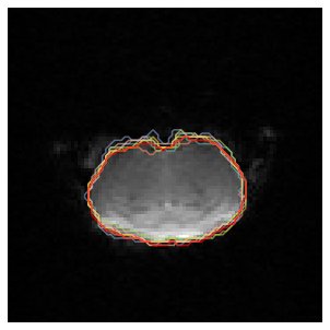 ../_images/notebooks_5_Disagreement_23_0.png