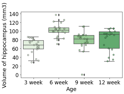 ../_images/notebooks_6_Volumetric_quantification_34_1.png